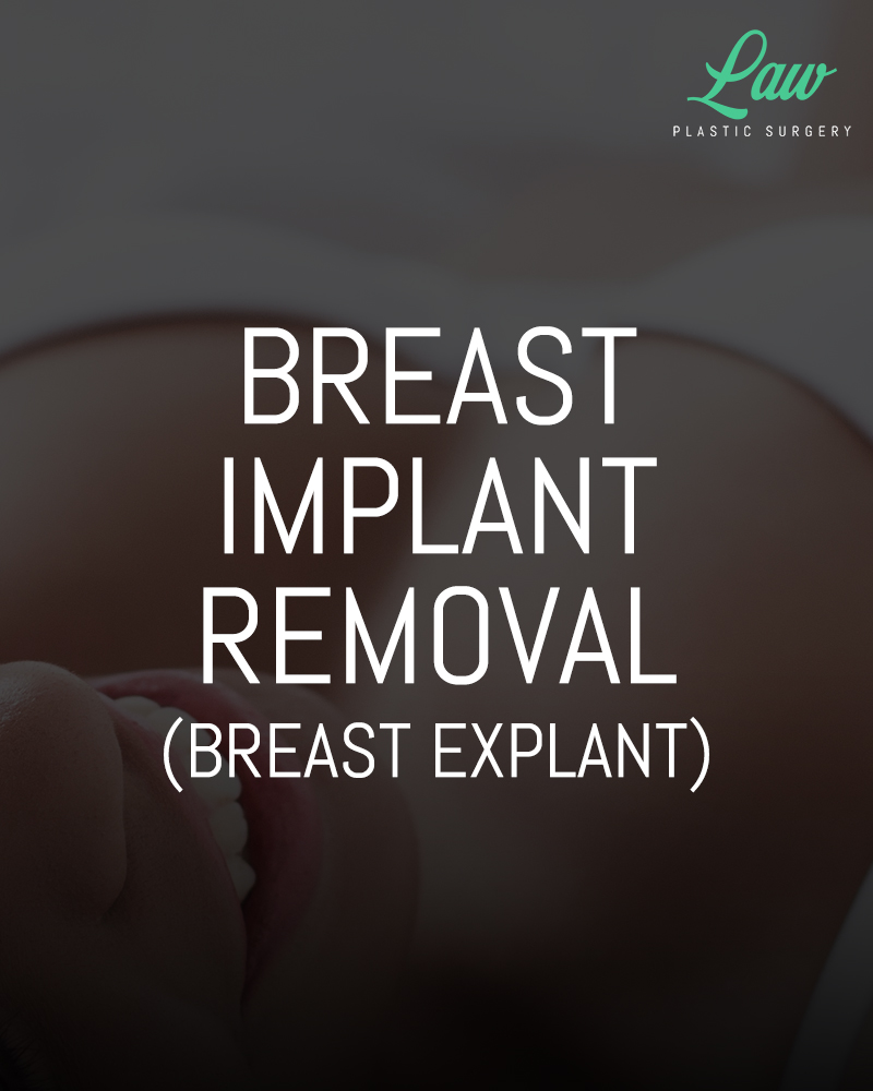 Breast lift (mastopexy) - series—Procedure: MedlinePlus Medical